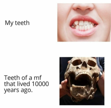 Teeth problems: (