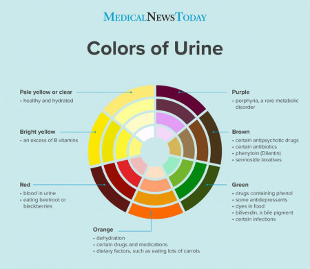 Colors of urine