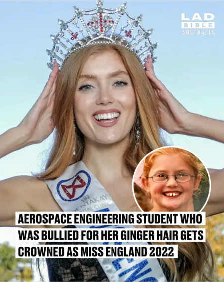 Well done Champ She is the first redhead to win the Title in Miss England&#039;s 94-year history