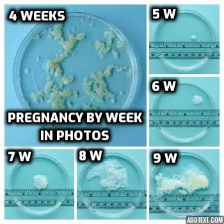 What a pregnancy actually looks like before 10 weeks – in pictures