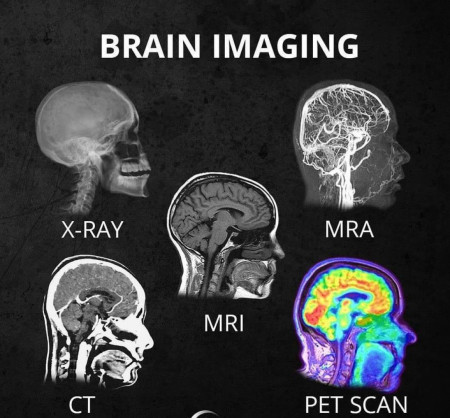 A cool guide to brain imaging