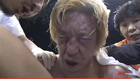 Takayama’s face after his famous “punching contest” with Don Frye (Pride Fighting)