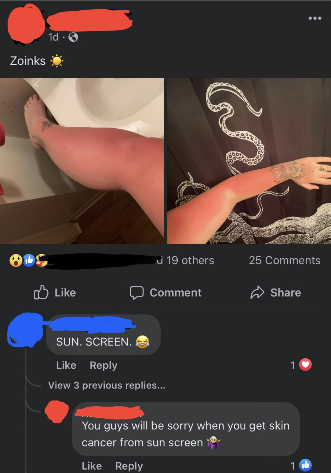 Sunburn and sunscreen