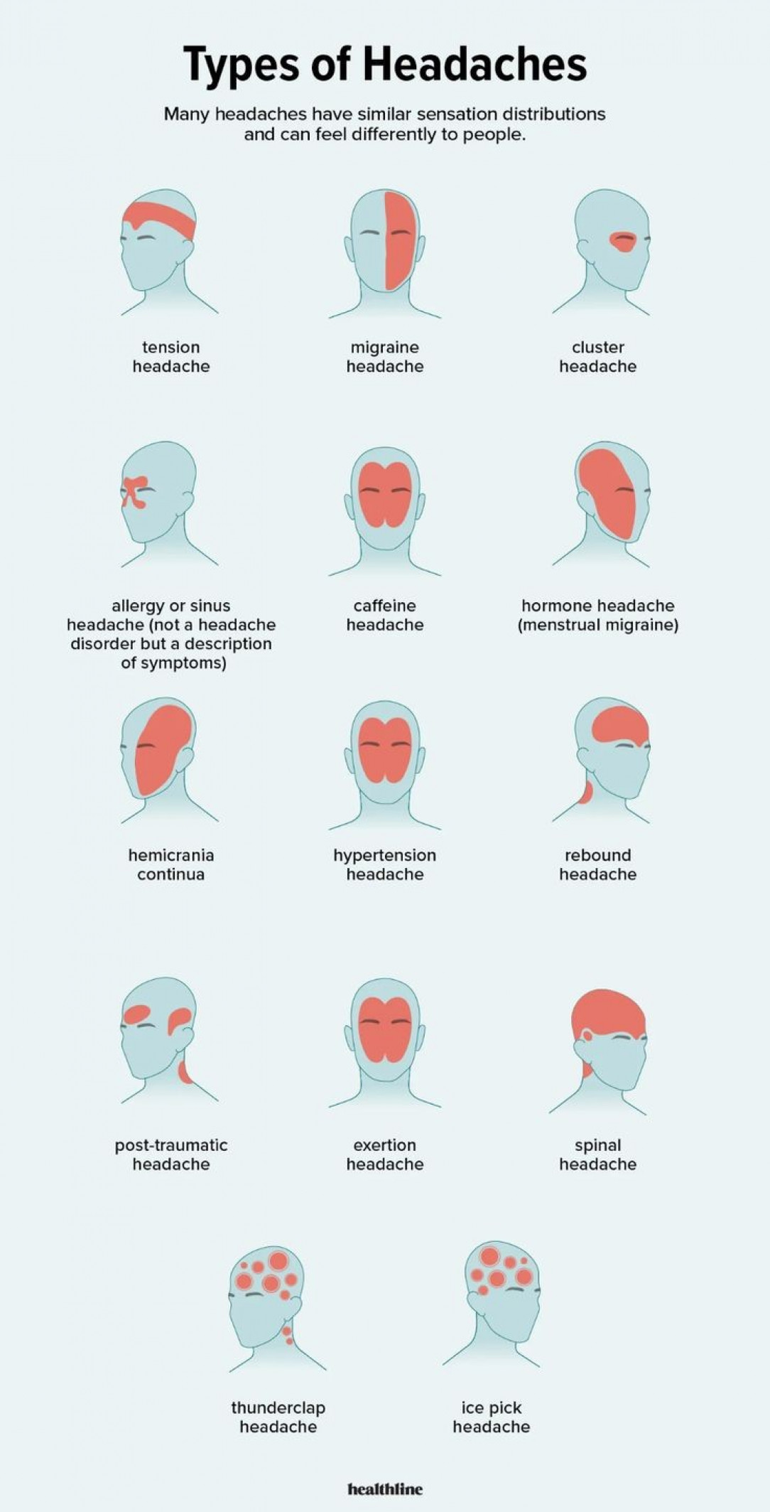 Types of Headache &amp;amp; Migraines