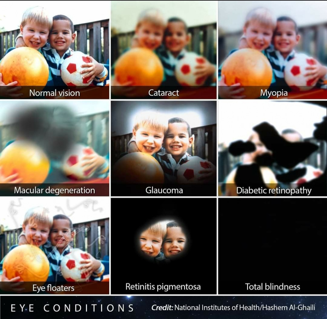What different eye conditions look like