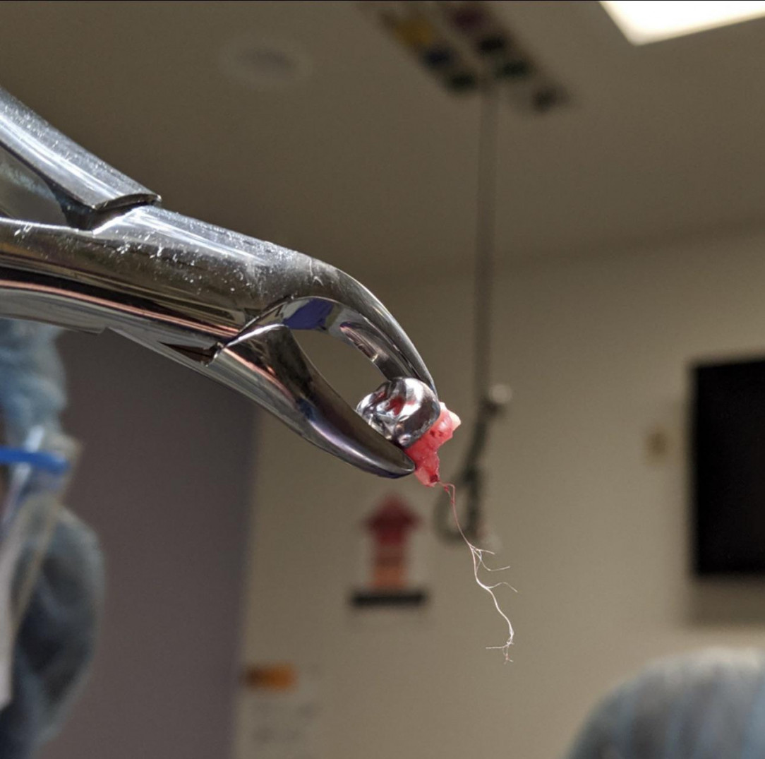 Extracted tooth with intact nerve root