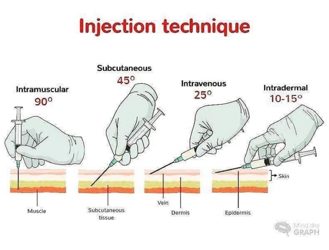 injection technique