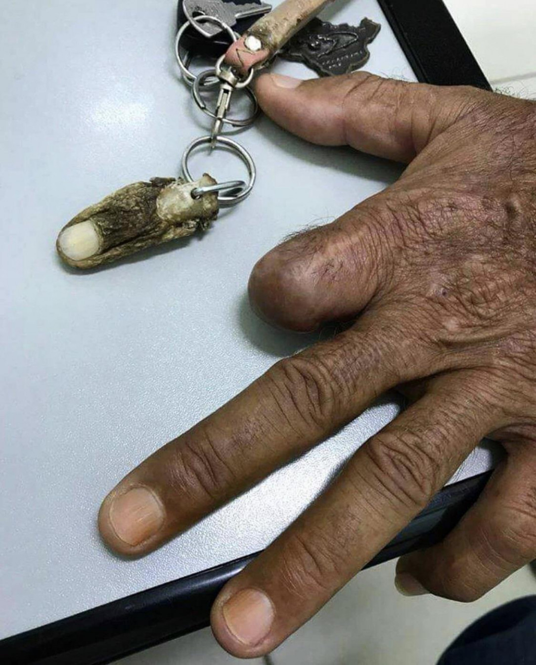 Amputated finger turns into a keychain 😵😱😳