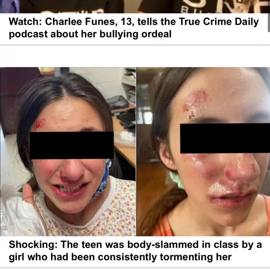 Bully who attacked 7th grader and her disabled friend and only got suspended for 3 days (link to article in comments)