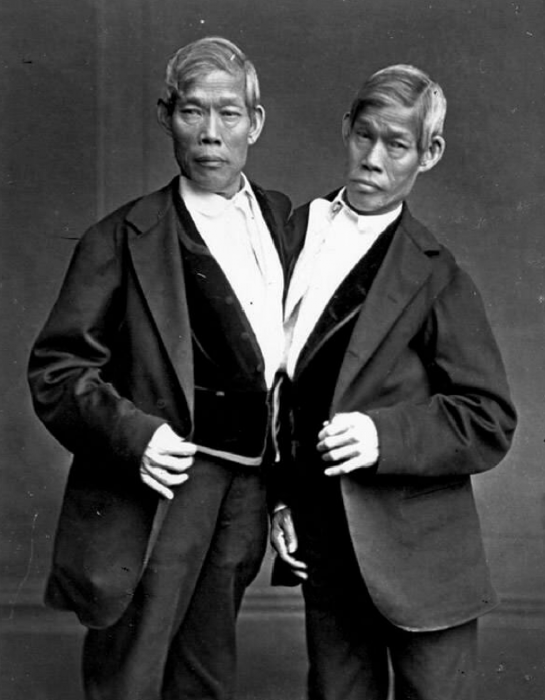 You know Chang and Eng Bunker, born in Thailand in 1811 as conjoined twins. But did you know they had a total of 21 children between them?