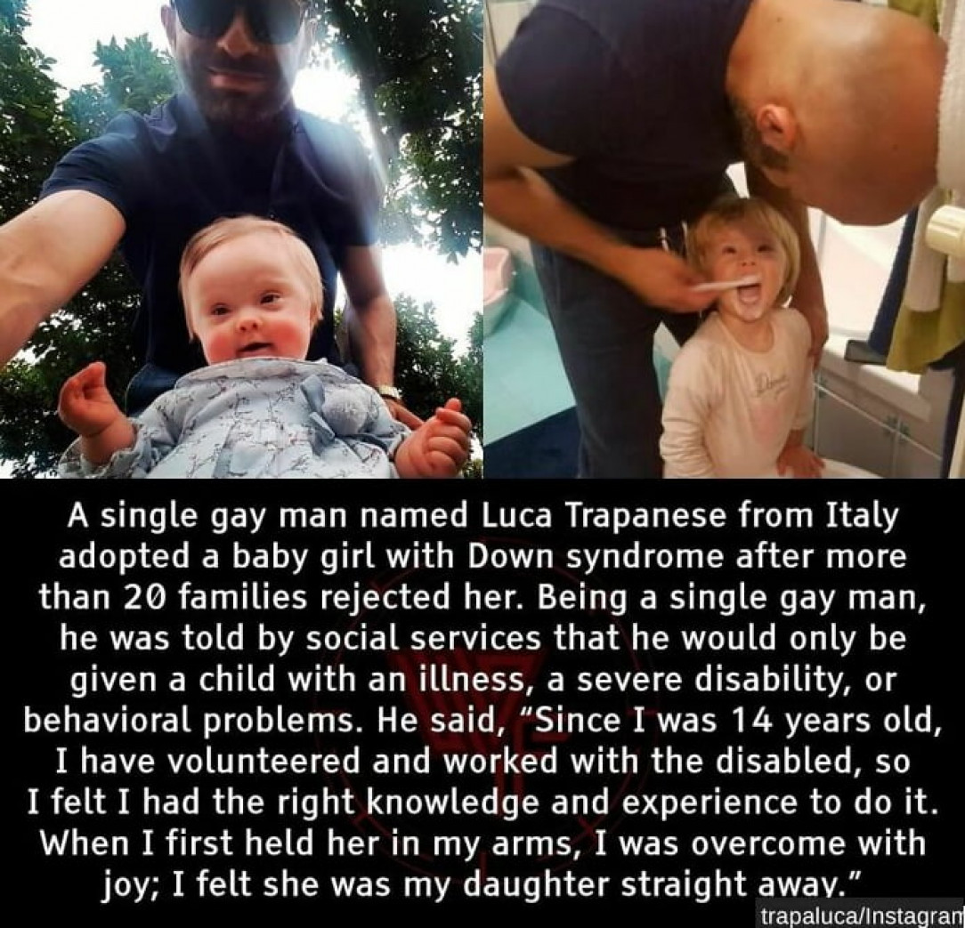 Down syndrome