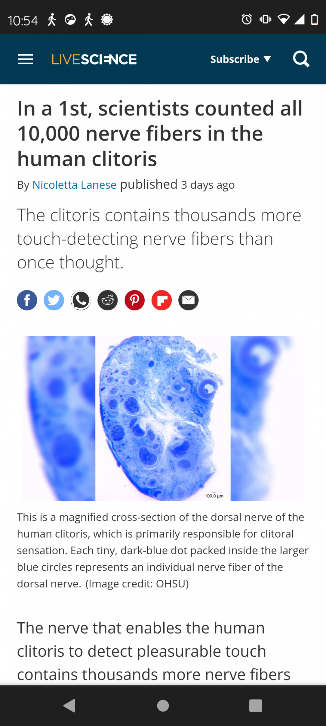 In a 1st, scientists counted all 10, 000 nerve fibers in the human clitoris!