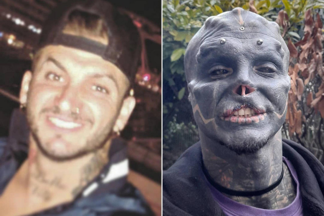 Anthony Loffredo AKA The Black Alien, before and after