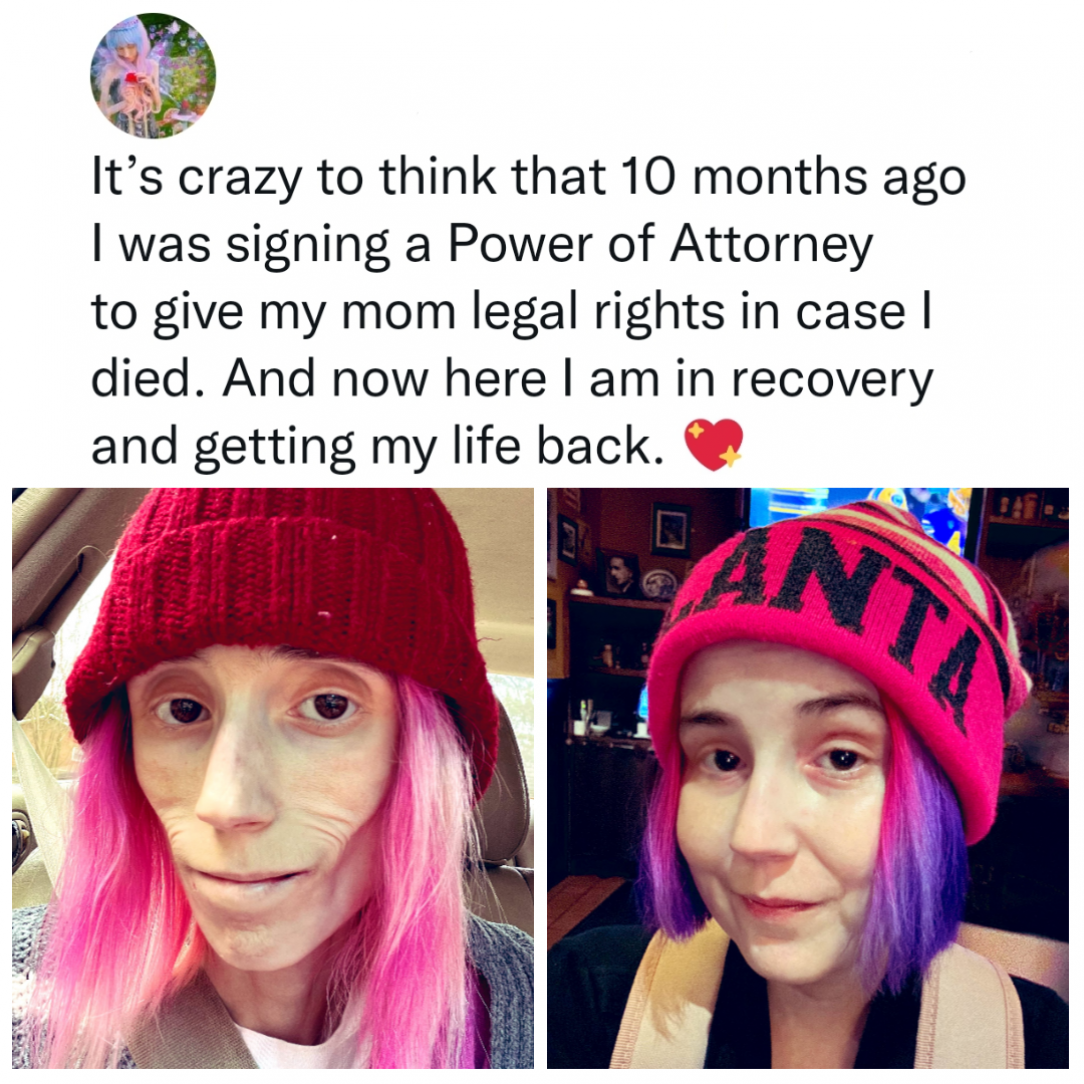 This woman making a miraculous recovery and getting her life back!