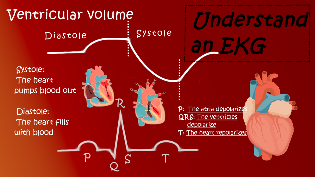 Understand an EKG