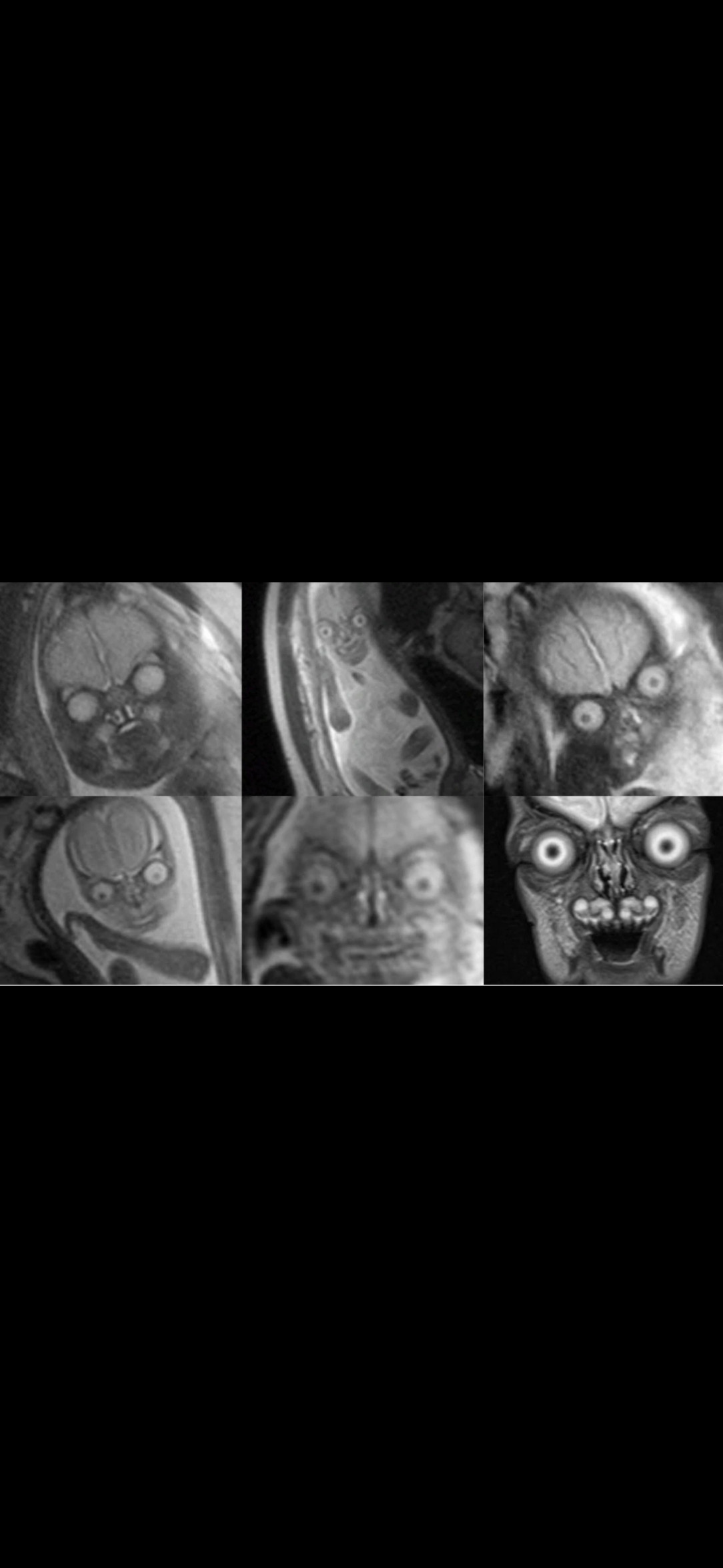 MRI Scans Of Babies