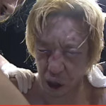 Takayama’s face after his famous “punching contest” with Don Frye (Pride Fighting)